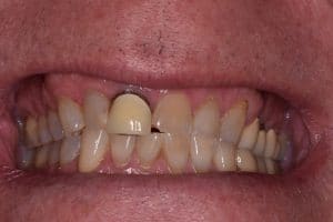Dentistry of Bethesda - Before Image 2