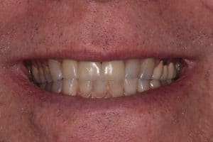 Dentistry of Bethesda - After Image 2