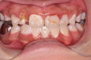Dentistry of Bethesda - Gallery Image 3