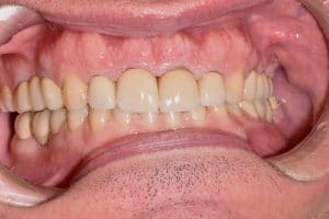 Dentistry of Bethesda - After Image 1